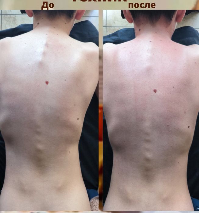 Остеопат Кинезиолог Массаж м. Пушкинская