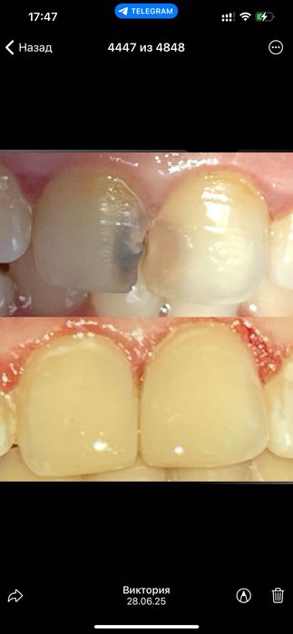 Услуги стоматолога г.Харьков