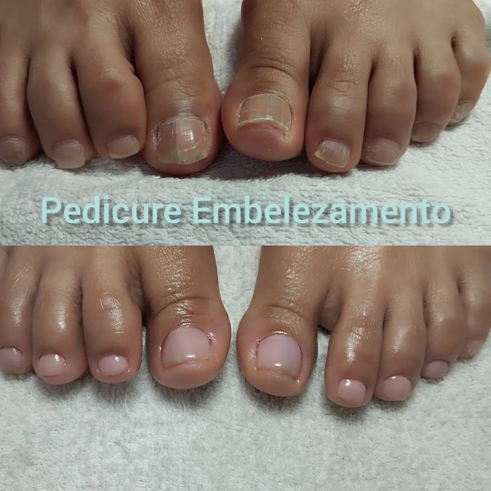 Pedy Clean, estética e cuidados específicos dos pés