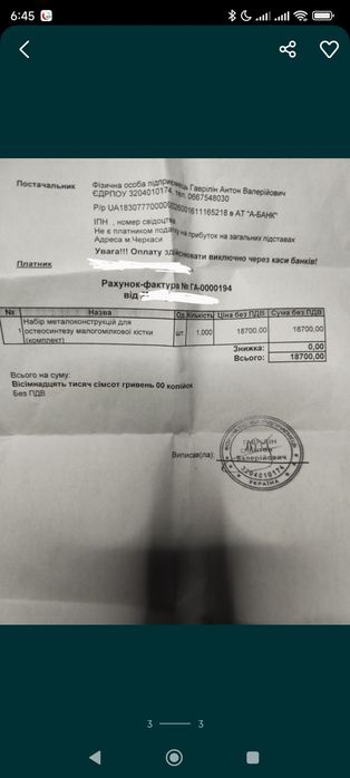 Титанова пластина для остеосинтезу малогомілкової кістки