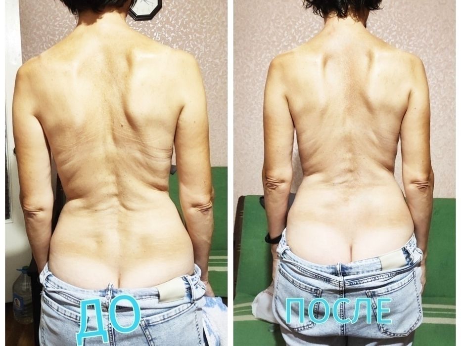 Костоправ ,устранение болей в спине