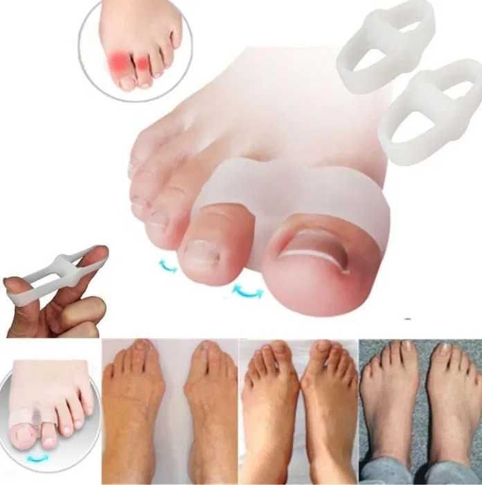 2x-corretor-dedo-grande-separador-suporte-p-calo-joanete-mindinho