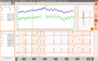 Cardioline Cubeholter Urządzenie Do Monitorowania EKG Holter Medyczny Profesjonalny Sprzęt Diagnostyczny Do Analizy Serca