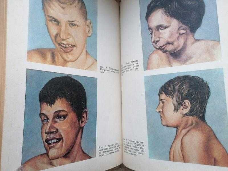 Л.О. Бадалян. Невропатология. Просвещение 1992.