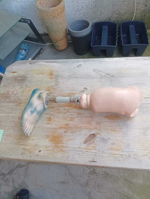 Proteza prawej nogi Otto Brock