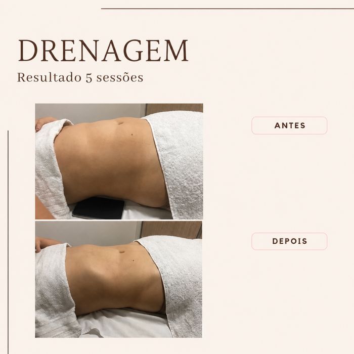 Drenagem linfática método Renata França