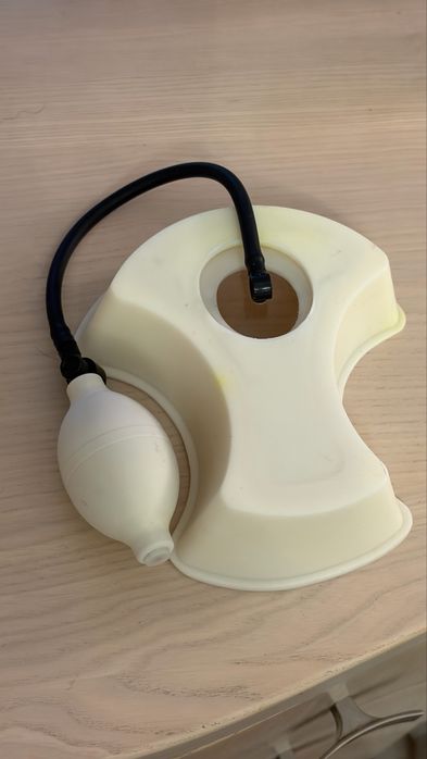 Вакуумний дзвін для виправлення лійкеподібноі форми грудної клітки