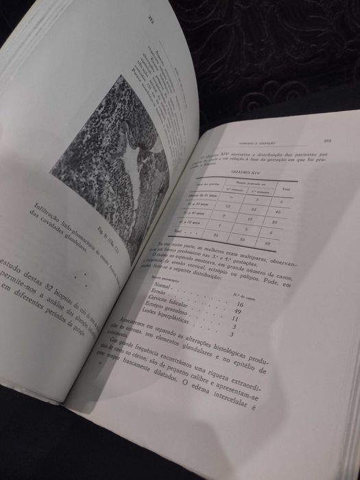Tumores e Gestação (Est. Clínico e Exper.) - João da Silva Carvalho