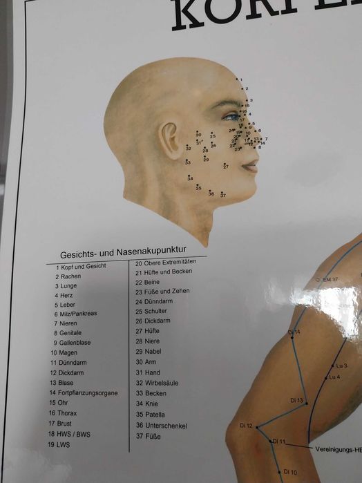 Posteres acupuntura