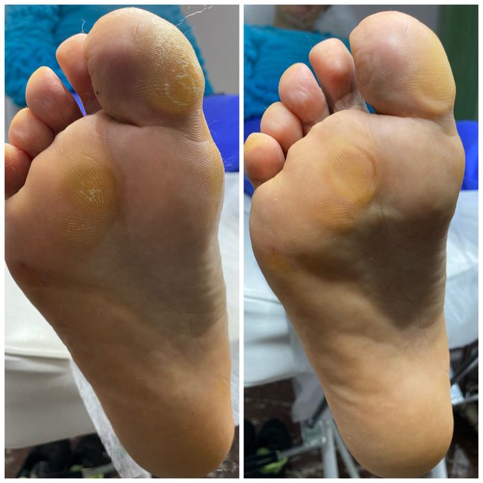 Подолог, педикюр Кривий Ріг