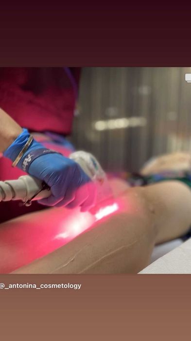 Depilação a Laser Corporal 4 em 1 com Laser de Três Ondas e Crioterapia. Lisboa