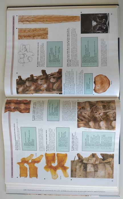 Atlas Anatomia Humana - 2 livros novos em Espanhol