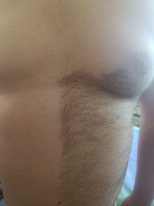 Депіляція для чоловіків, всі  зони