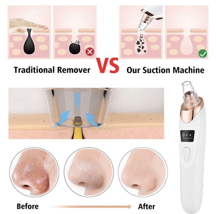 Вакуумный Очиститель Пор