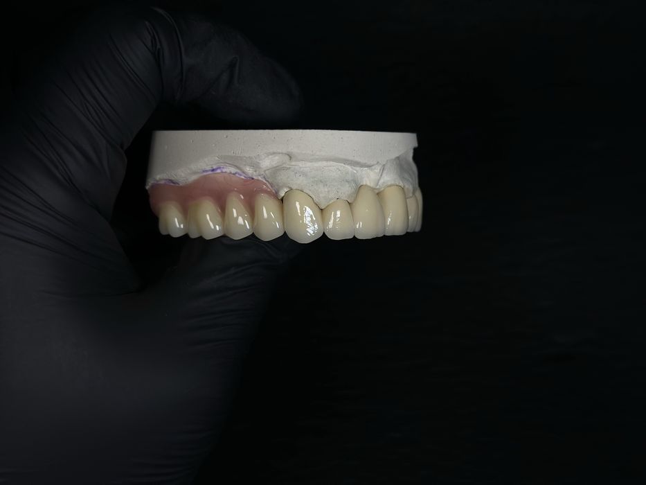 Послуги зубного техніка