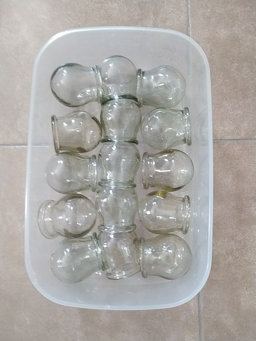 Банка лікувальна баньки