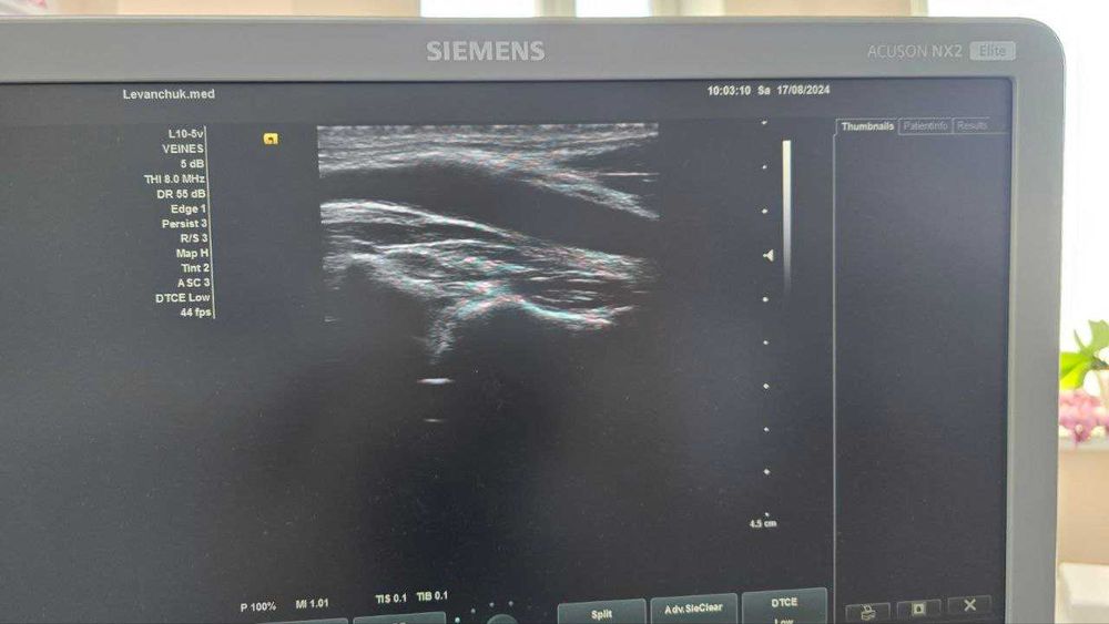 Лінійний датчик УЗД Siemens L10-5V