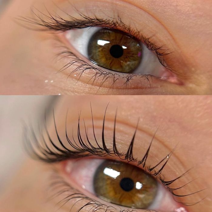 Молекулярна реконструкція. Ламінування Вій та Брів