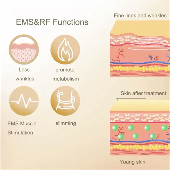 Многофункциональный RF + EMS аппарат для лица и тела