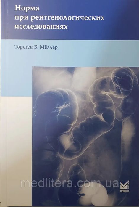 Меллер Т. Б. Норма при рентгенологічних дослідженнях 4-е видання