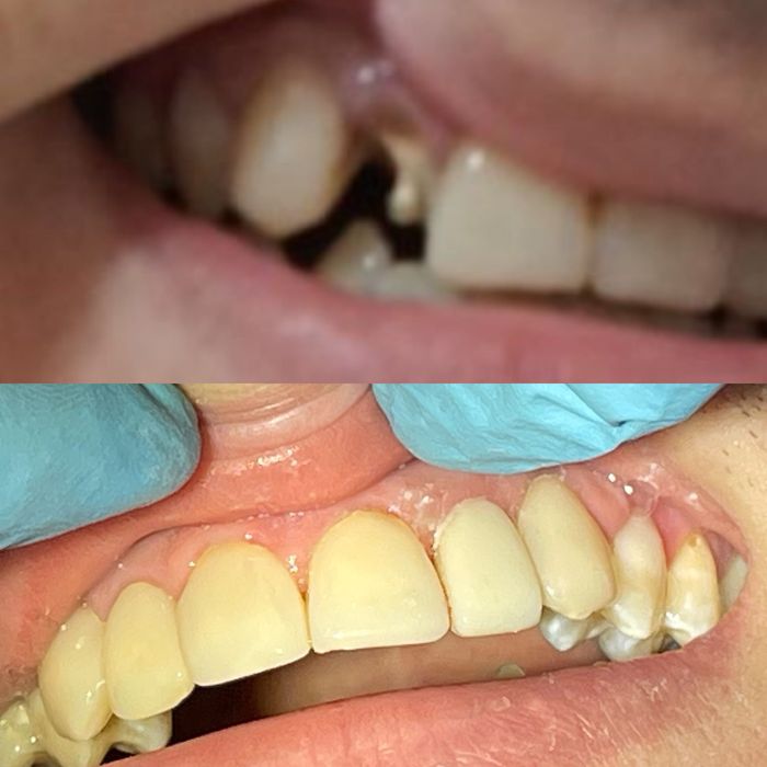 Услуги стоматолога г.Харьков