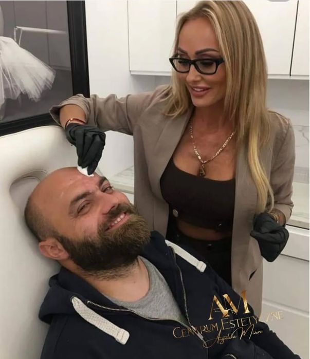 Kwas hialuronowy, botox
