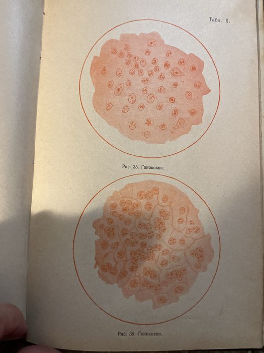 Антикварна кнга з медицини 1909р.