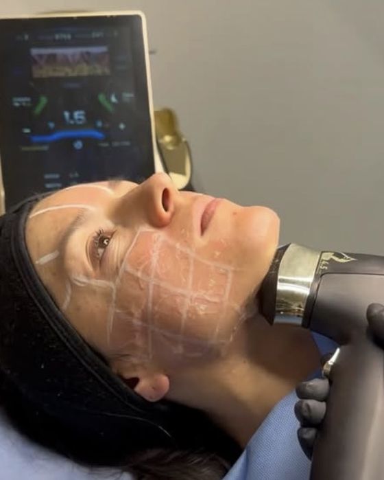 Maquina HIFU 22D max