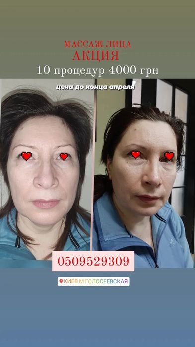 Міофасціальний,  моделюючий, лімфодренажний масаж обличчя + маска