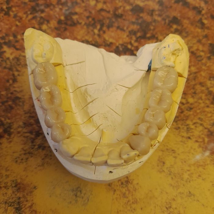 Зубний    технік