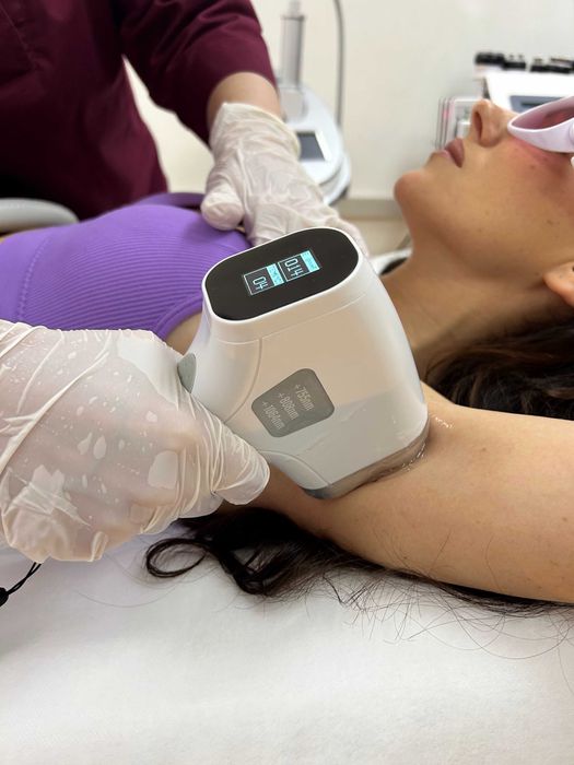 Лазерна епіляція, яка дійсно працює