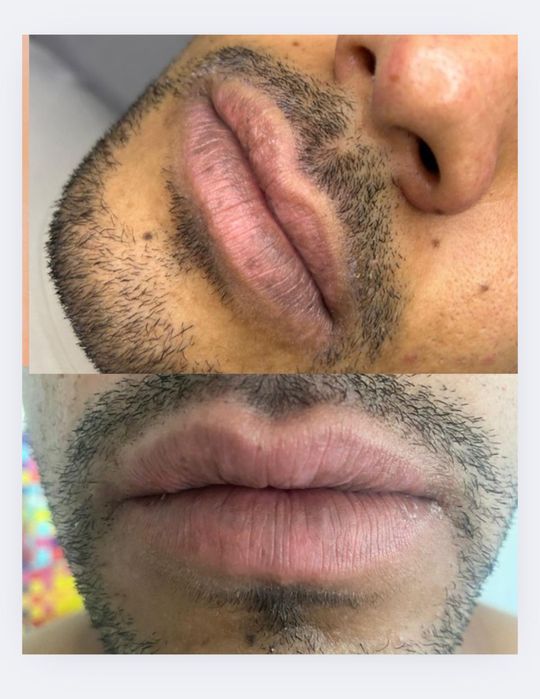 Micropigmentaçao labial e sobrancelhas