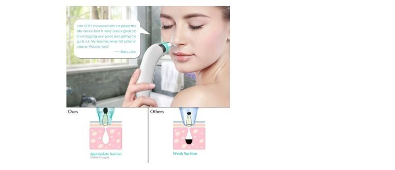 Usówanie zaskórników ,Nowy  odkurzacz wągrów, peeling, oczyszczanie po