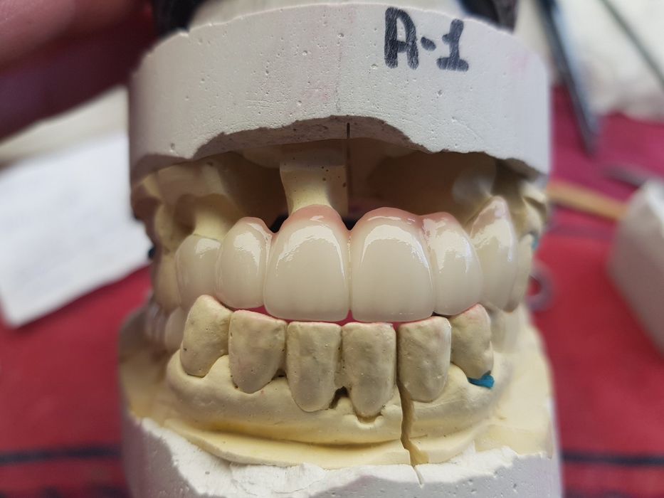 Зубний    технік