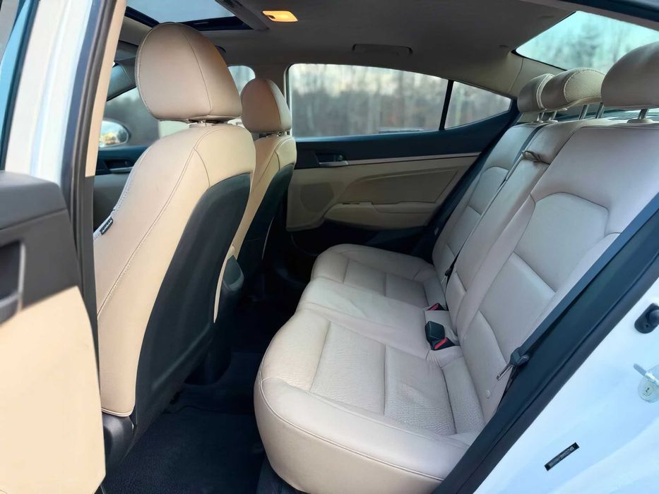 Hyundai Elantra      2017