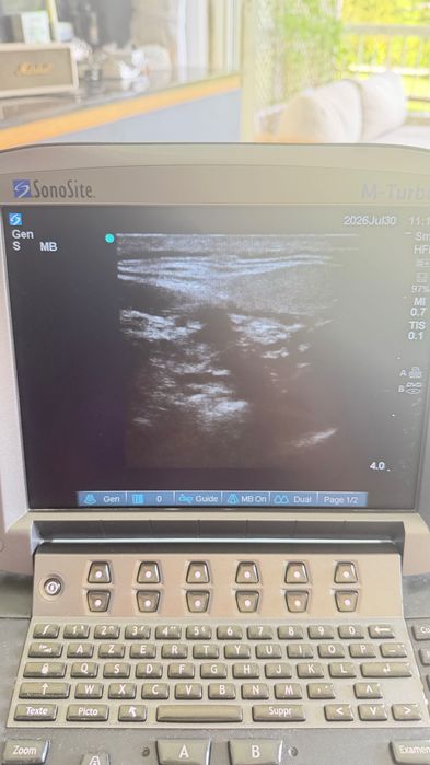 узд sonosite turbo M