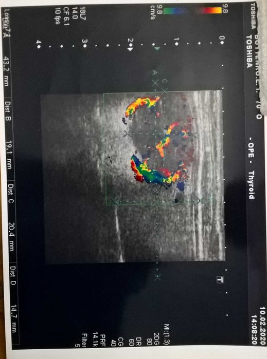 Аппарат УЗИ экспертного класса - Toshiba APLIO MX
