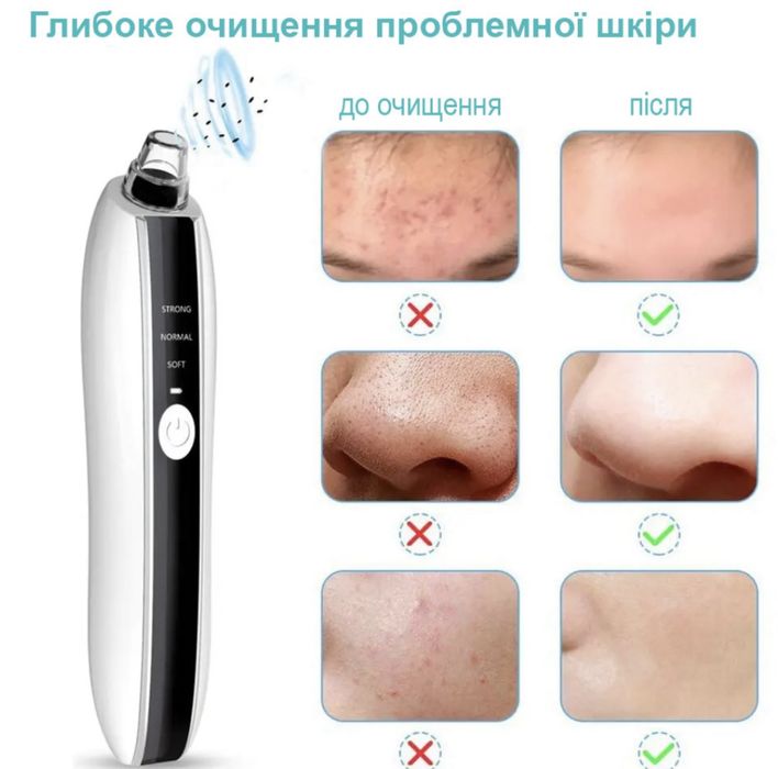 Вакуумний очищувач шкіри, пристрій для видаленя вугрів PRITECH