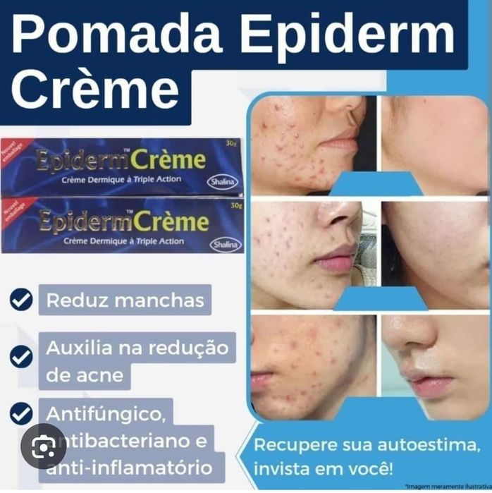 Creme do rosto para manchas
