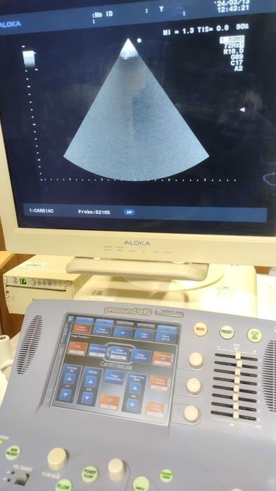 Aparat USG Aloka ProSound a10 Pilnie Okazja