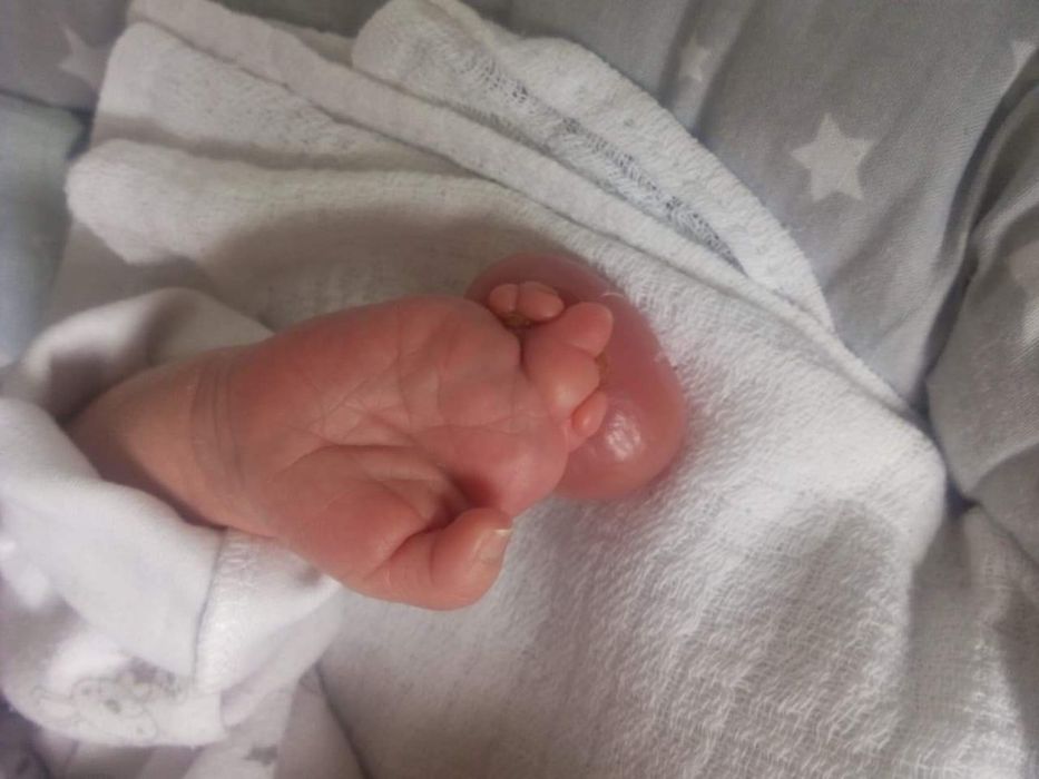 Podaruj 1, 5 % podatku, pomożesz Tadziowi!