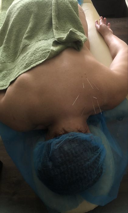 Послуги реабілітолога(online) послуги масажиста