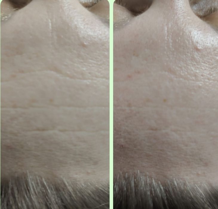 Pierwszej masaż u  Leszka 20% taniej!