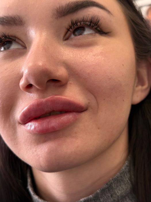 Збільшення губ. Потрібні моделі