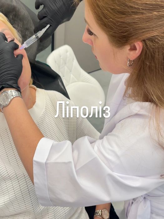 Косметолог. Контурна пластика губ, мезотерапія, біоре-ція, ліполітик.