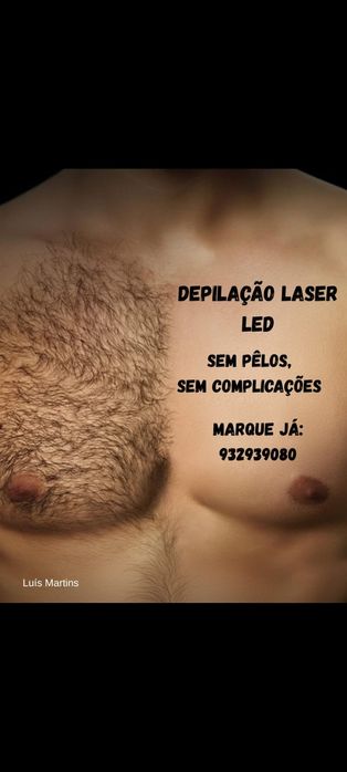 Depilação a laser