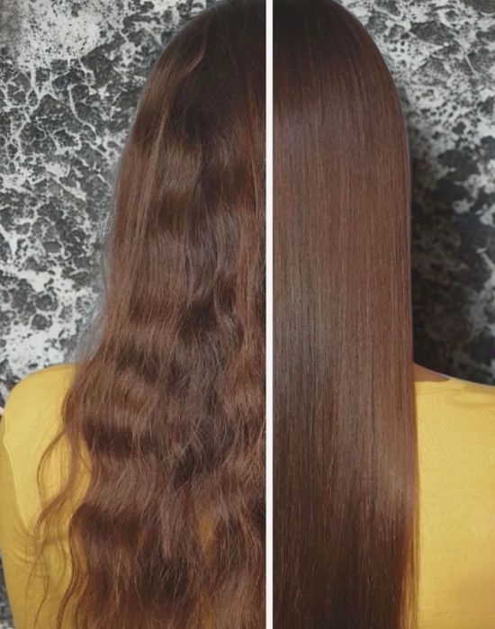 Nanoplastia i botoks - poszukiwane modelki