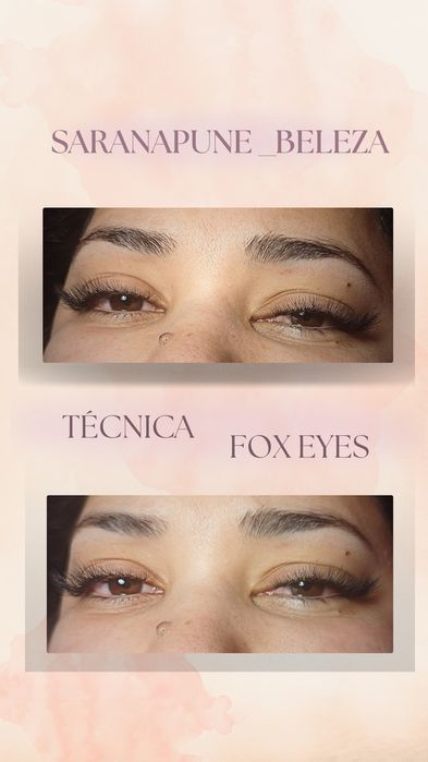 Estética Avançada (Micropigmentaçao Facial , Tratamento de estrias…)