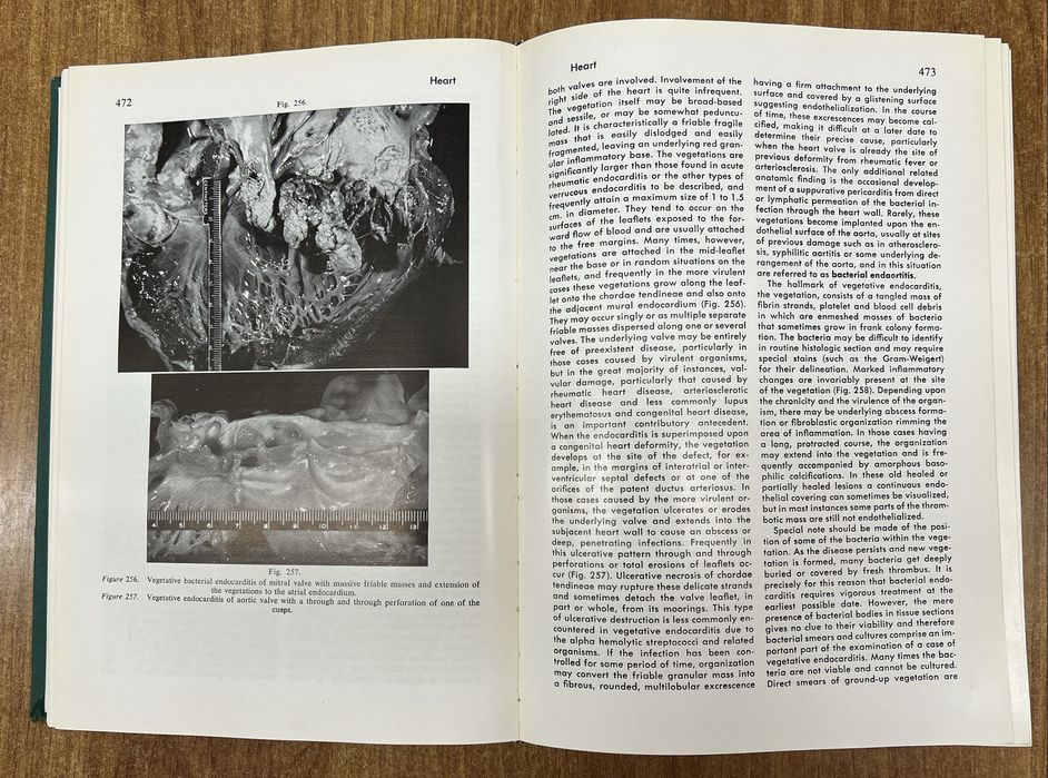 «Textbook of Pathology» Stanley L. Robbins, 1st Ed. «Патологія»