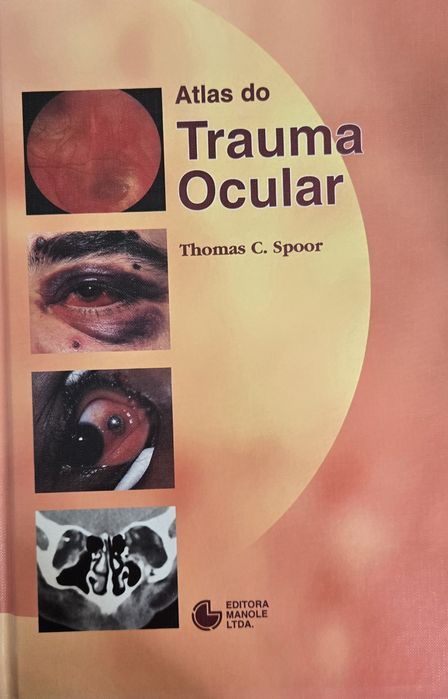 Atlas do Trauma Ocular